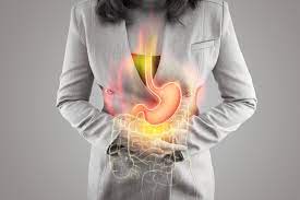 Acid Reflux